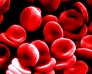 anemia-1