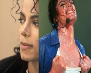 casos-de-vitiligo-1