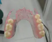 Prótese Dentária de Silicone Fixa (10)