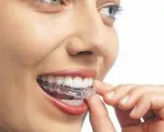 Prótese Dentária de Silicone Fixa (14)