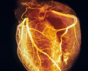 qual-o-significado-de-infarto-do-miocardio-parte-2-4