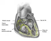 qual-o-significado-de-infarto-do-miocardio-parte-2-6