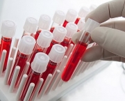 Blood samples in test-tubes