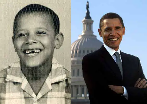 Barack Obama - Antes e Depois