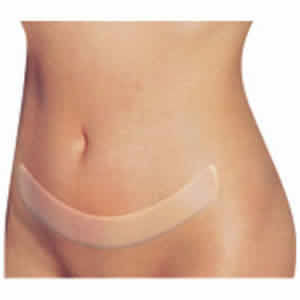 Abdominoplastia