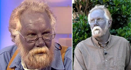 Homem da Pele Azul com Angyria Homem da Pele Azul com Angyria