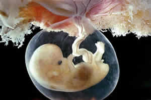 Embrião