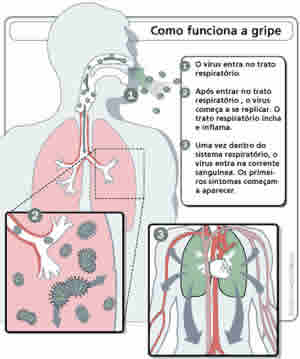 Sintomas Gripe Aviária