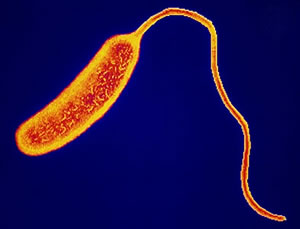 Vibrio Cholerae