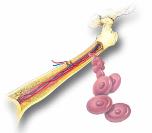 Leucemia Crônica Leucemia Crônica