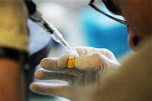 A Vacina Contra o HIV A Vacina Contra o HIV