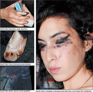 Amy Winehouse Escândalos