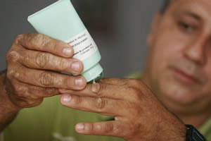 vitiligo-1 Tratamento