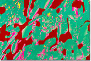 Demerol Effects
