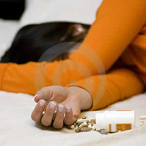 Paracetamol Overdose