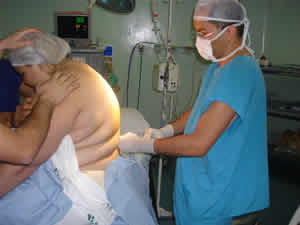 Cirurgia Bariátrica Tipos