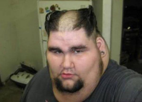 Gente De Cabelo Feio Imagens
