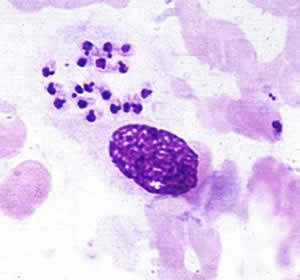 Agente Causador Meningite Bacteriana Agente Causador Meningite Bacteriana