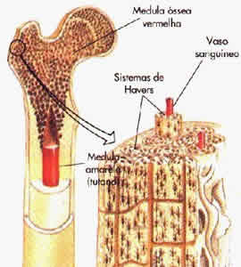 leucemia-1 Crônica