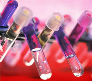 Leucemia Aguda Mieloide