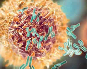 linfoma-1 Linfoma