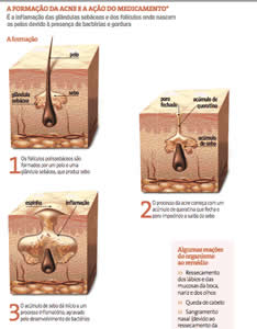 remedio-2 Bula