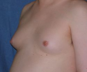 sindrome-1 Tratamento