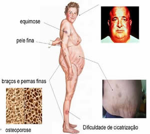 sindrome-1 Tratamento