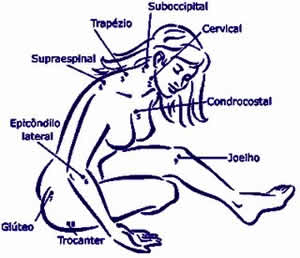 Fibromialgia 