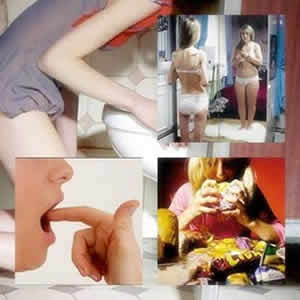 disturbio-alimentar-3 Bulimia