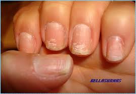 unhas