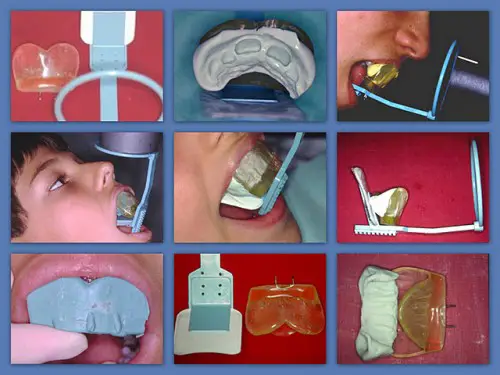 Tecnologia Na Configuracao Interna Dental