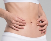 Abdominoplastia (3)