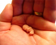 aborto-espontaneo-14