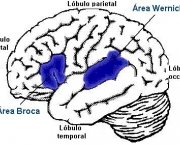 afasia-progressiva-primaria-5