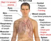 anemia-4