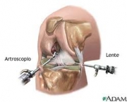 anestesia-local-e-regional-6