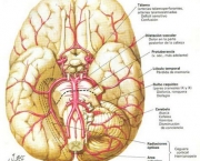 aneurisma-cerebral-8