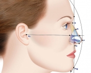 Causas de Erros nas Rinoplastias (7).jpg