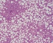 celulas-do-figado-10