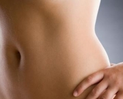 Cicatriz de Abdominoplastia (8)