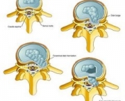 coluna-vertebral-anatomia-3