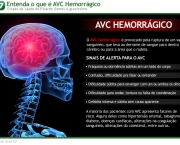 como-acontece-um-avc-2