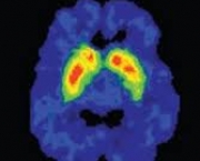 como-as-drogas-afetam-o-cerebro-coroe-4