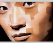 como-e-classificado-o-vitiligo-6