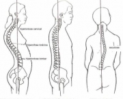 como-prevenir-a-escoliose-2