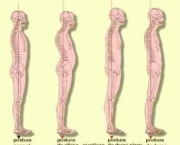 como-prevenir-a-escoliose-3