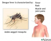 dengue-hemorragica-9