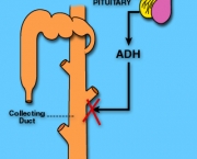 Diabetes Insipidus (1)