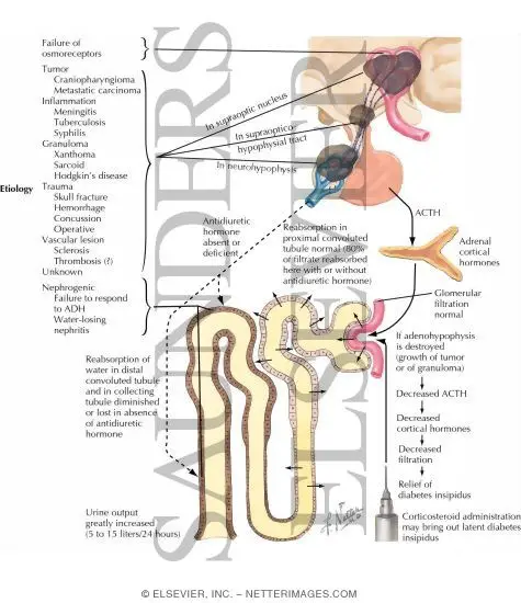 diabetes insipidus labor lexikon